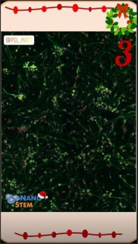 Neural Stem Cells can be cultured in the lb. In the picture, the nuclear protein PAX6 was stained in red and the protein NESTIN in green. The red nuclei and the green protrusions make the NSC looks like a Christmas holly!